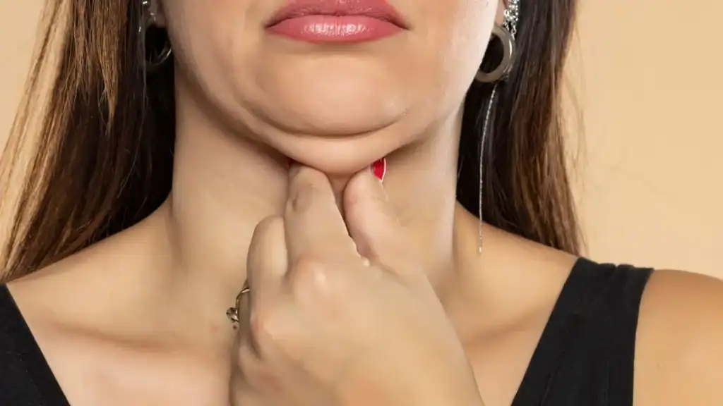 An image of a woman with double chin, sad, worried : Non Surgical Double Chin Removal Treatment in Liberton, UK
