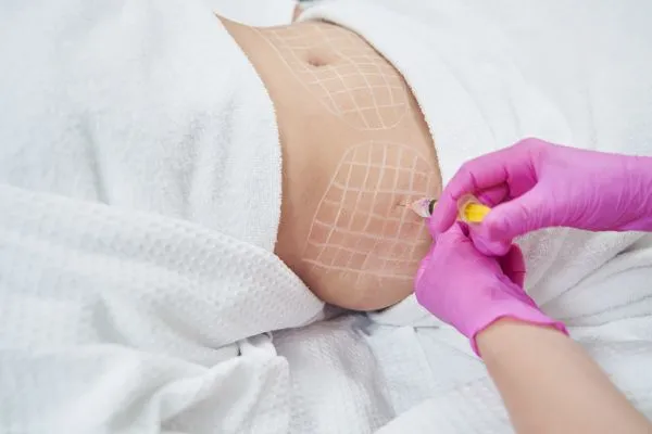 image of fat dissolving injections on love handles to help combat weight gain Liberton